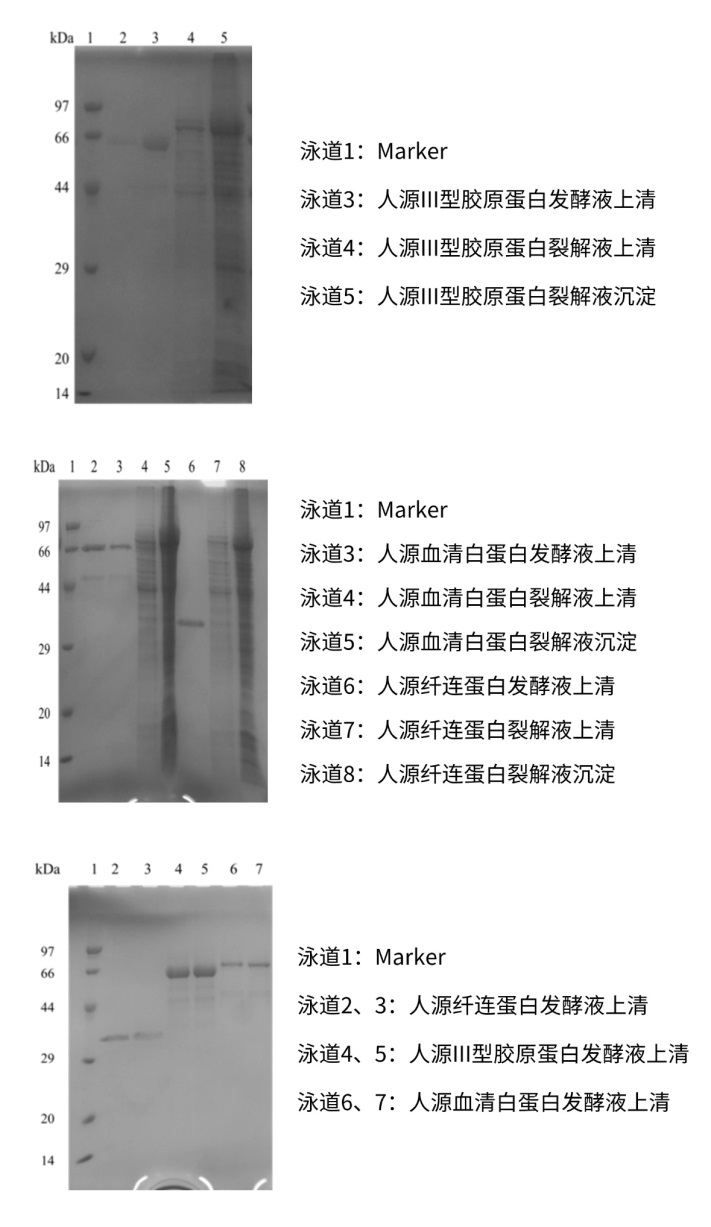 合成生物学底盘细胞之毕赤酵母